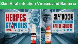 Skin viral infection  Bacterial growth  staphylococcus  Chickenpox Harpers  heart diseases [upl. by Oicneserc77]