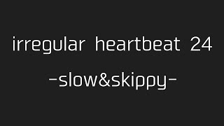 徐脈amp期外収縮3連発（irregular heartbeat 24  slowampskippy） [upl. by Stilla]