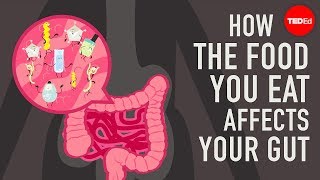 How the food you eat affects your gut  Shilpa Ravella [upl. by Bertero]