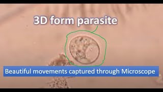 Motile trophozoite of Trichomonas under the Microscope [upl. by Anthony579]