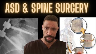 ASD and Why understanding it may change your mind about spine surgery [upl. by Thatcher]