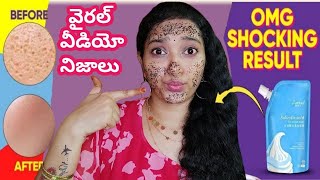 Salicylic Acid Mask in TeluguSalicylic Acid Ice Cream Mask Review in TeluguSalicylic acid icecream [upl. by Dloreh]