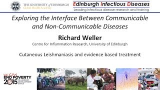 Cutaneous Leishmaniasis  Richard Weller University of Edinburgh [upl. by Si]