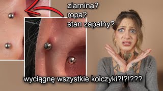 POPSUŁAM SOBIE PIERCING  WSZYSTKO O MOIM NOWYM PIERCINGU [upl. by Imojean]