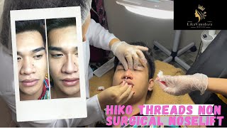 Hiko Threads NonSurgical Noselift  Albert Flores [upl. by Rekcut841]