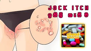 ඉකිලි කැසීම​ට බෙහෙත්  Jock Icth [upl. by Theone]