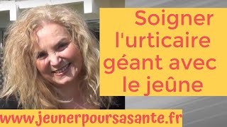 Comment Olga soigne son urticaire Géant avec le jeûne thérapeutique [upl. by Hildagard]