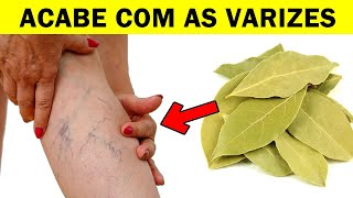 Diga Adeus às VARIZES e às DORES NAS ARTICULAÇÕES Com Essa Receita Caseira varizes [upl. by Towill916]