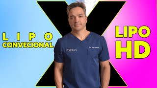 Diferenças entre LIPO Convencional x LIPO HD [upl. by Malia]