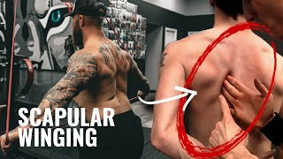 Top Exercises to Fix Scapular Winging  Punchers Muscle [upl. by Anirbaz278]