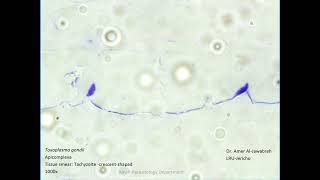 Toxoplasma gondii Tachyzoites [upl. by Dira921]