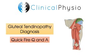 Classic Gluteal Tendinopathy Diagnosis  Clinical Physio [upl. by Mora]