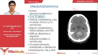 Tumores del Sistema Nervioso  Neurología  Villamedic Clínicas [upl. by Mcadams]