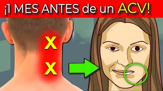 7 SEÑALES de ADVERTENCIA 1 MES ANTES DE UN ACV ICTUS CEREBRAL [upl. by Okoyik]