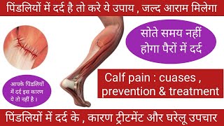 Calf pain  causes prevention and treatment । पिंडलियों में दर्द के कारण  ट्रीटमेंट  घरेलू उपचार । [upl. by Charis]