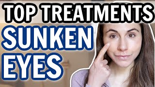 TOP TREATMENTS FOR SUNKEN EYES amp HOLLOWS 👀 Dermatologist DrDrayzday [upl. by Novihc636]