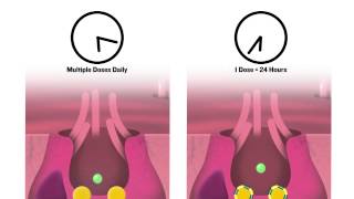 Preventing and Treating Equine Stomach Ulcers [upl. by Suitangi]