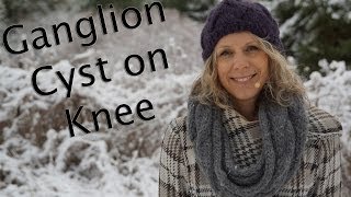 Ganglion Cyst on Knee Can Yoga Help [upl. by Siwel]