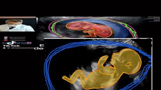 Gravidez 13 semanas gestante gravidez ultrassom gestacao bebe [upl. by Dowd366]