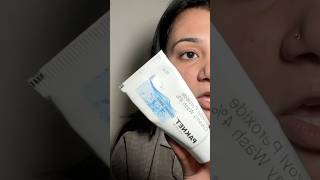 benzoyl peroxide for acne prone skin [upl. by Boor263]