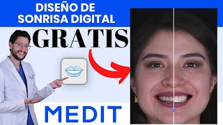 🤓 Diseño de Sonrisa Digital GRATIS  Medit Smile Design paso a paso [upl. by Azmuh]