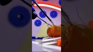 How laparoscopic surgery are done shortsvideo [upl. by Audie]