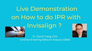 How to do IPR with Invisalign [upl. by Crockett80]