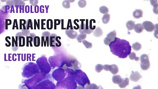 Paraneoplastic syndromes  Detailed explanation [upl. by Eiramadnil946]