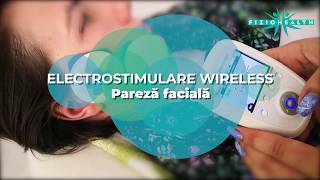 Pareza faciala electrostimulare wireless [upl. by Ocir687]