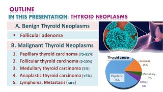 Thyroid neoplasmsTumors  شرح محاضرة [upl. by Dustan]