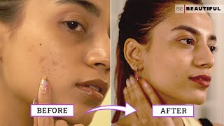 How To Improve Your Skin Texture  Skincare Tips For Bumpy Skin  Be Beautiful [upl. by Akcire]