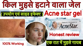 AcneStar Gel  Use Benefits Composition Side Effects and Price  How to Apply amp Precautions [upl. by Jerad970]