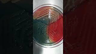 microbiology test for uti using CLED Agar lactofermentation medicalfield biology science [upl. by Antoine262]