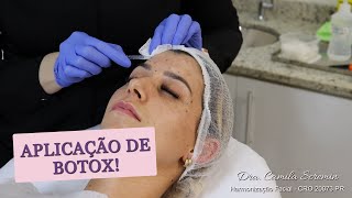 Aplicação e Resultados da Toxina  Antes e Depois  Dra Camila Scremin [upl. by Ayojal]