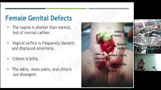 Bladder Extrophy and Epispadias Complex [upl. by Gaul]