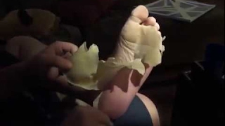 Crazy amount of skin peeling from a foot [upl. by Corbett518]