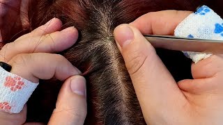 Gentle ASMR Scalp Care No Talking Soothing Dandruff Removal [upl. by Ayatal]