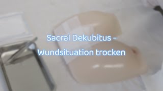 Sacral Dekubitus  Wundsituation trocken [upl. by Ablasor]