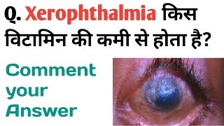 Xerophthalmia किस विटामिन की कमी से होता है [upl. by Guendolen]