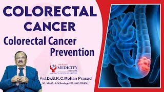 Colon Cancer Symptoms  Colorectal Cancer  Colorectal Cancer Prevention in English [upl. by Sousa]