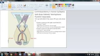 Psychology 306 Biopsychology  Chapter 16 Commissurotomy in Human Epileptics [upl. by Zacherie]