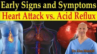 Identifying Heart Attack vs Acid Reflux GERD Early Warning Signs amp Symptoms  Dr Mandell DC [upl. by Esir]