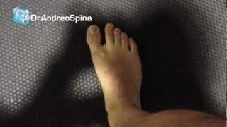 Intrinsic Foot Strengthening by Dr Spina [upl. by Nodmac]