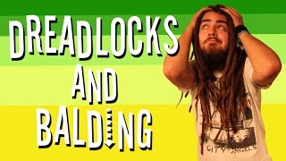 DREADLOCKS AND BALDING [upl. by Nosremaj]