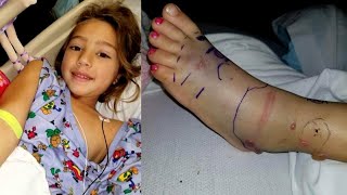 Brave 5YearOld Recovers in Hospital From Venomous Snake Bite [upl. by Zuliram98]