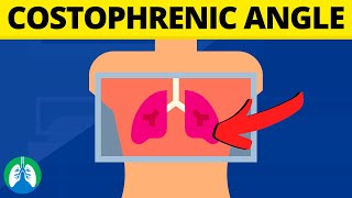 Costophrenic Angle Medical Definition  Quick Explainer Video [upl. by Naerda886]