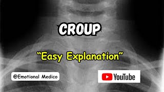 Croup  Acute LaryngoTracheoBronchitis  ENT  emotionalmedico [upl. by Ogram752]