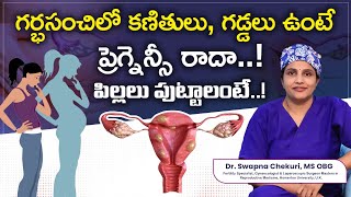 Understanding Uterine Fibroids And Causes  DrSwapna Chekuri  Hyderabad Fertility Center [upl. by Pogue]