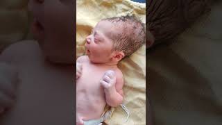 Baby Born after prolonged labourshorts viral [upl. by Mikey]