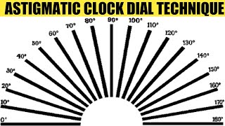 Astigmatic Clock Dial amp Fogging Technique  AK Khurana  Dr Saud Javed [upl. by Urbanna]